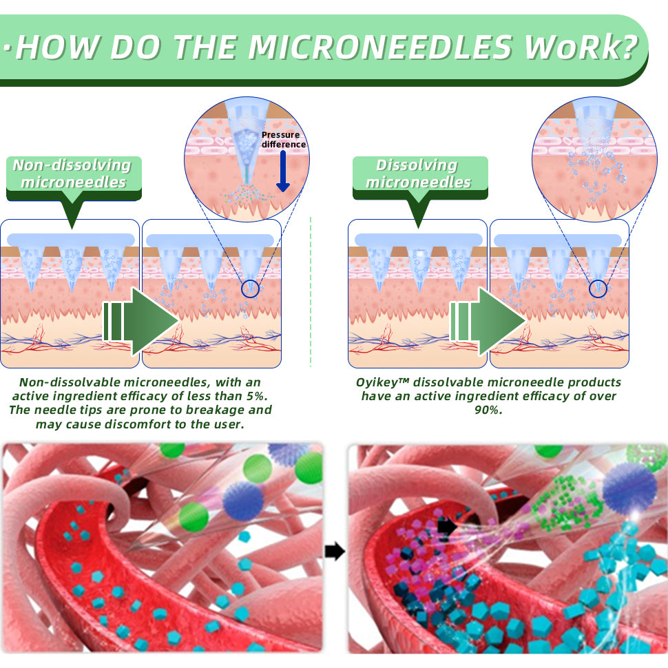 See results in 7 days🌲LOVILDS™ SMGT-GLP-1 Nano Microneedle Patch（Painless, long-lasting, addressing diabetes, obesity, and cardiovascular diseases）