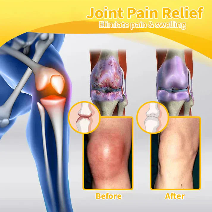 VENOLYX™ Bee Venom Rapid Therapy Joint Cream｜Deep Penetration for Joint Repair