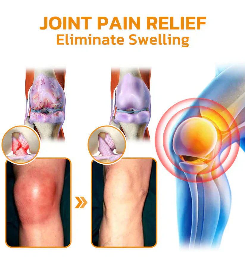VENOLYX™ Bee Venom Rapid Therapy Joint Cream｜Deep Penetration for Joint Repair