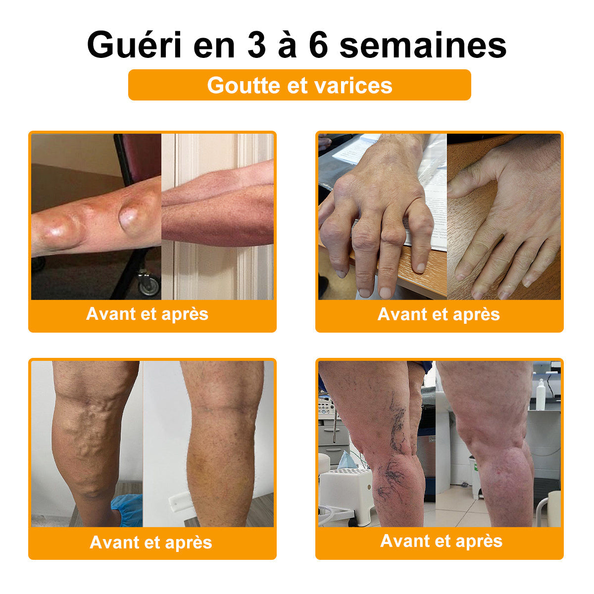 ADNOON®  Crème de guérison des os et de soulagement de la douleur au Botox et venin d'abeille