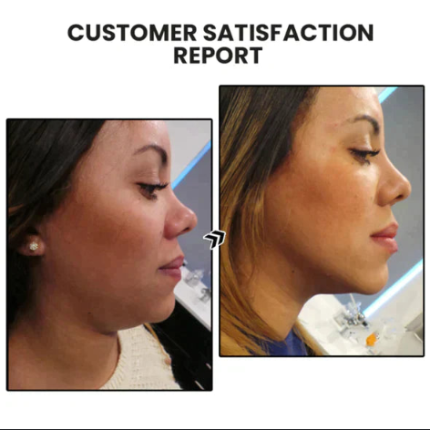 （🔥LAST DAY SALE-80% OFF)Histone Lymphatic activity hoop earrings