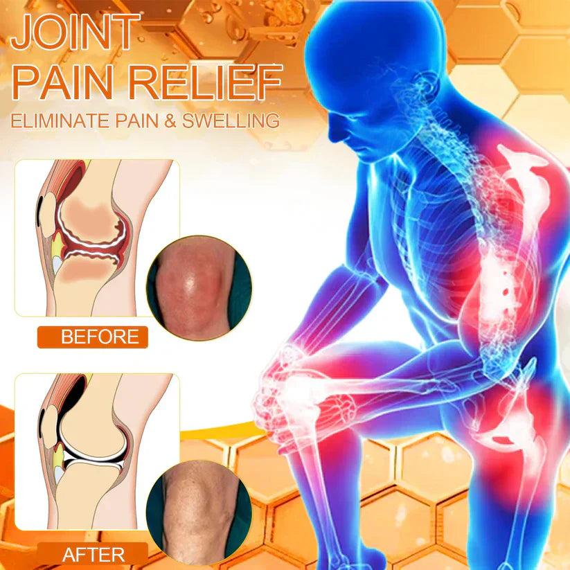 VENOLYX™ Bee Venom Rapid Therapy Joint Cream｜Deep Penetration for Joint Repair