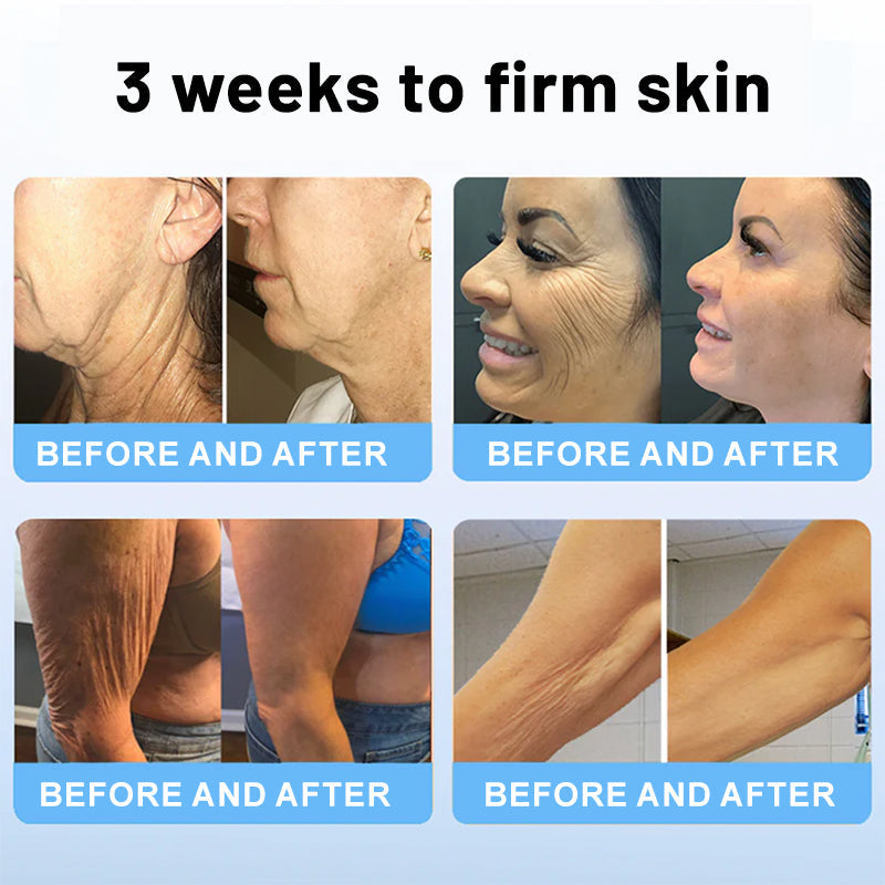 💖💖HZA™ Collagen Peptides  FIRMING SERUM STICK