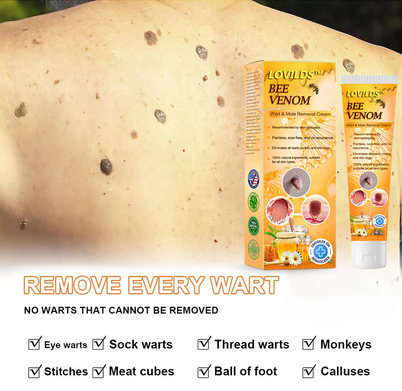 LOVILDS™ Bee Venom Wart & Tag Removal Cream(👨‍⚕Suitable for all skin types)🐝