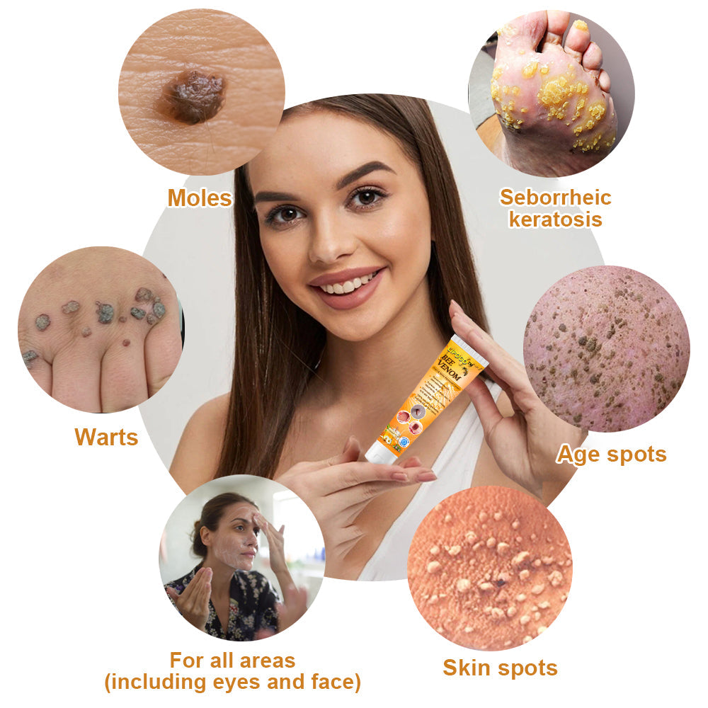 LOVILDS™ Bee Venom Wart & Tag Removal Cream(👨‍⚕Suitable for all skin types)🐝