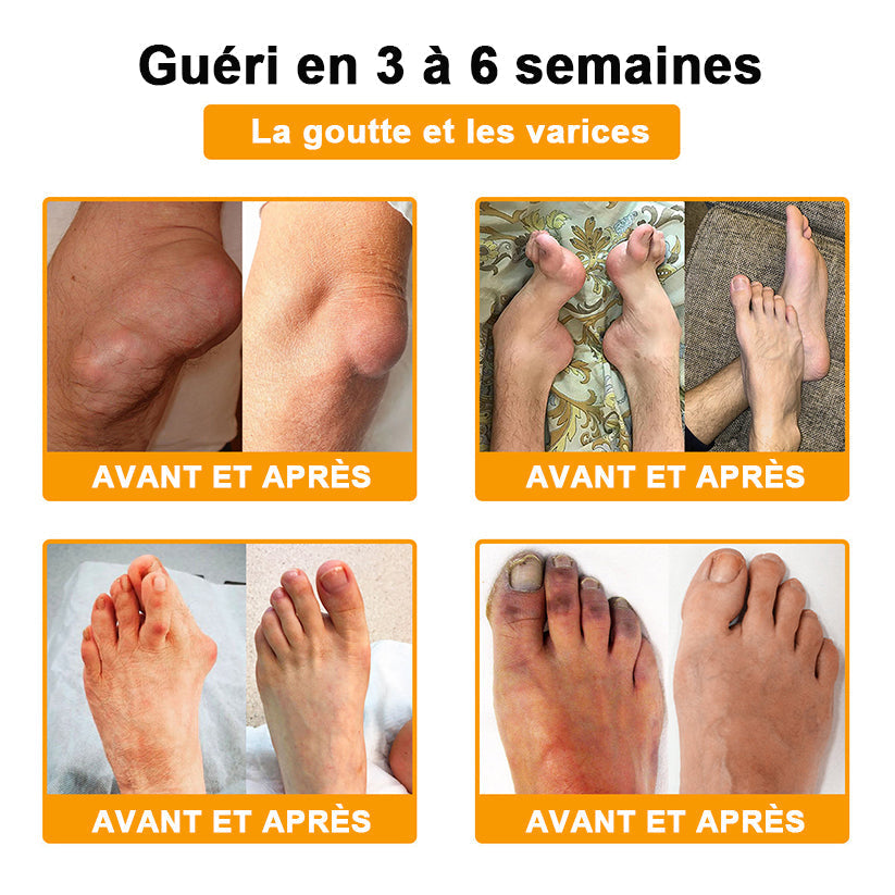 ADNOON®  Crème de guérison des os et de soulagement de la douleur au Botox et venin d'abeille