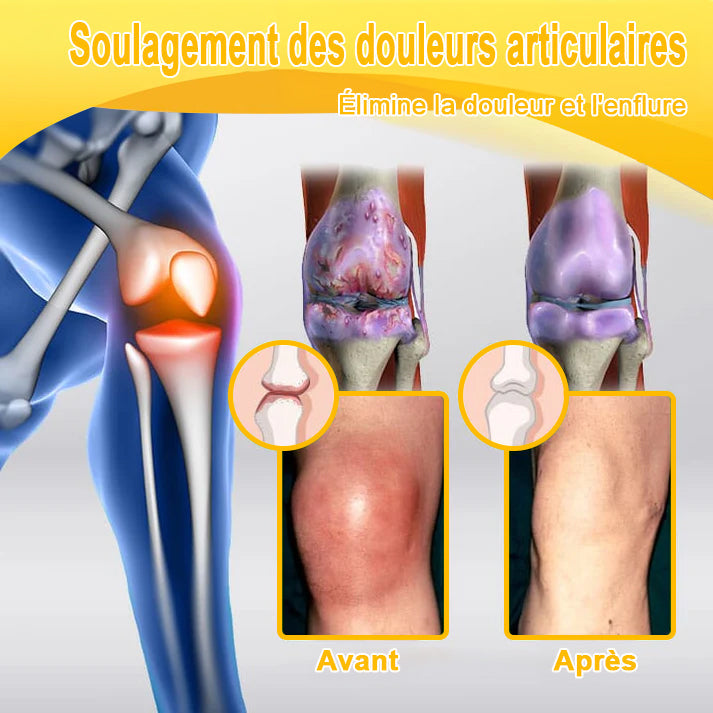 ADNOON®  Crème de guérison des os et de soulagement de la douleur au Botox et venin d'abeille