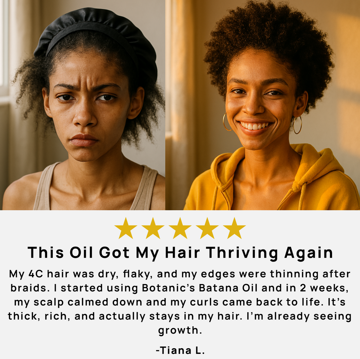 Avichic™ Batana Hair Growth Oil – 100% Unrefined Natural Formula for Thicker, Fuller Hair | 120ml