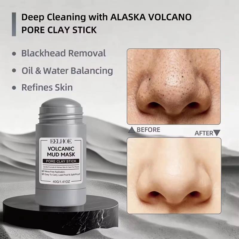 Clay Mask Stick for Deep Pore Cleansing – Kaolin Face Mask with Roller Ball Applicator