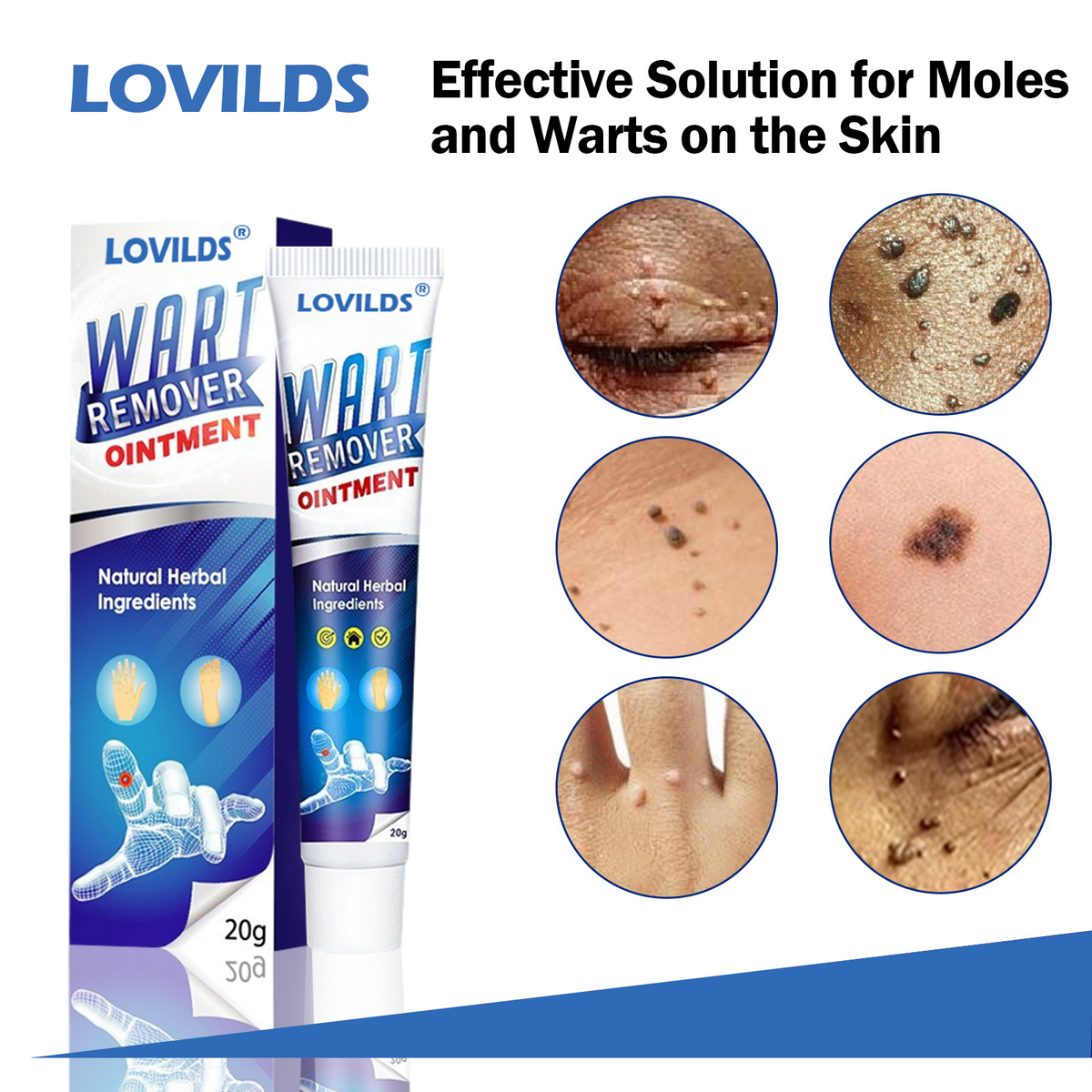 [🏆Official Flagship Store] 🔥LOVILDS® Wart remover ointment（👩‍⚕️AAD Doctor's Recommendation）