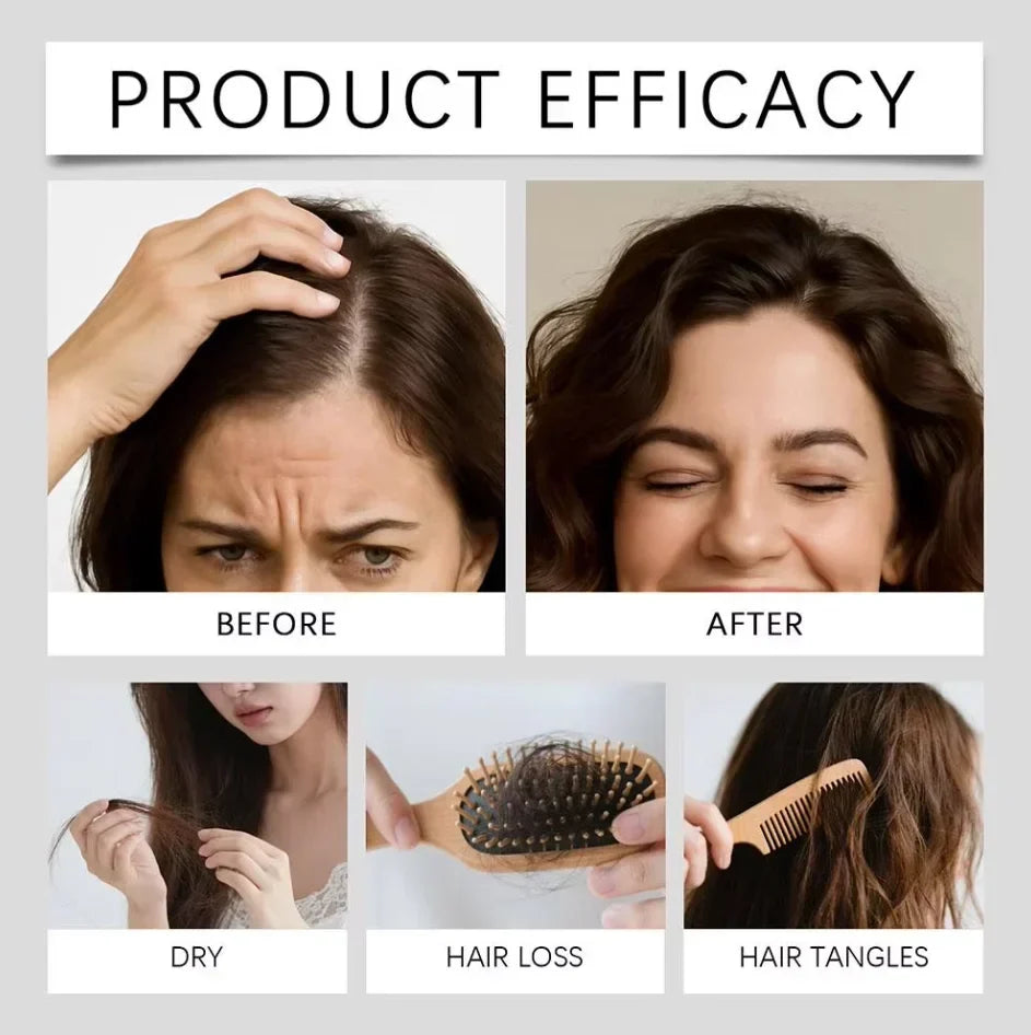 Microneedle Scalp Care Kit with 9 x 5ml Nourishing Scalp Serum and 0.2mm Needle Head