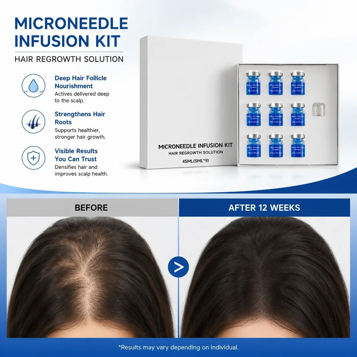 Microneedle Scalp Care Kit with 9 x 5ml Nourishing Scalp Serum and 0.2mm Needle Head