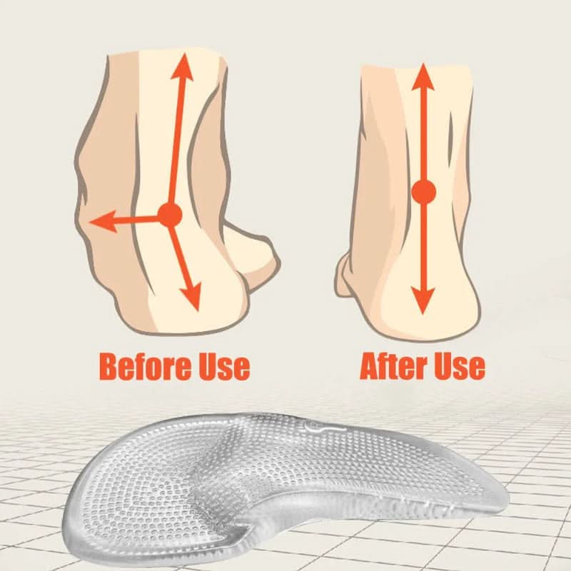 GELSTRIDE – Silicone Gel Orthopedic Insoles for All-Day Comfort
