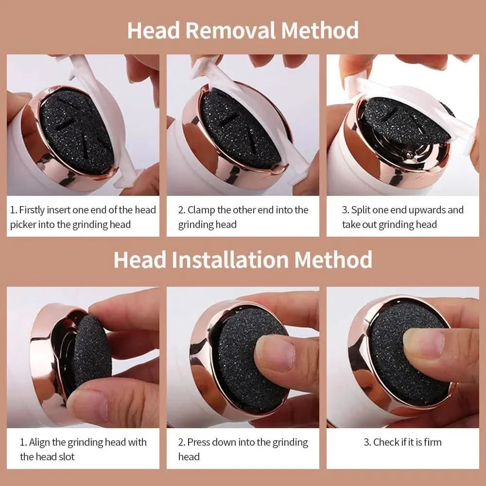 KallusCare – Rechargeable Callus Remover for Smooth & Silky Feet