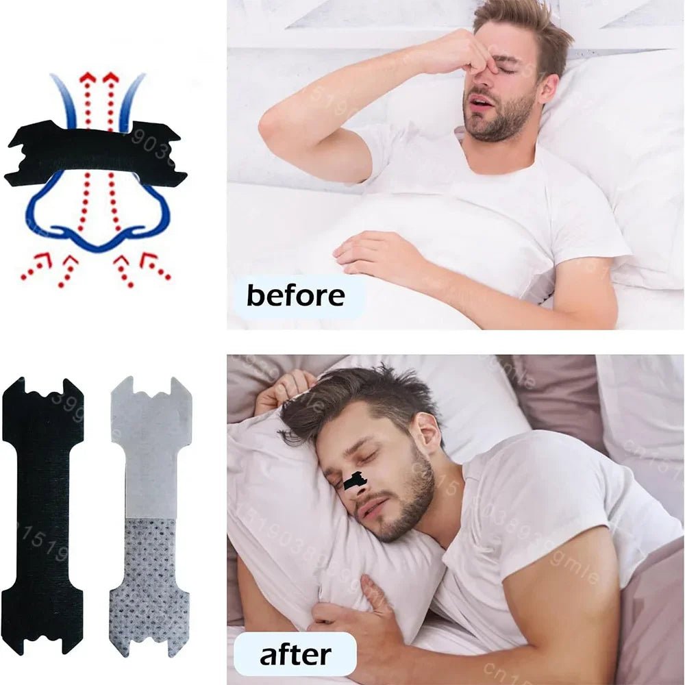 SPORTBREATHE – Nasal Breathing Strips for Enhanced Airflow & Active Performance